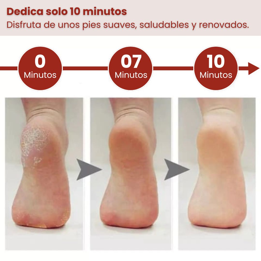 LIMA ANTICALLOS - 🚫 No más pies agrietados